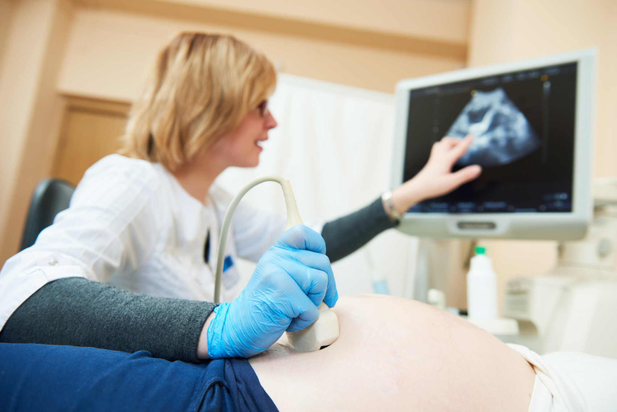 ultrasound technician research topics